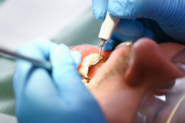 Best Urgent Care for Lost Fillings or Crowns in University At Buffalo, NY